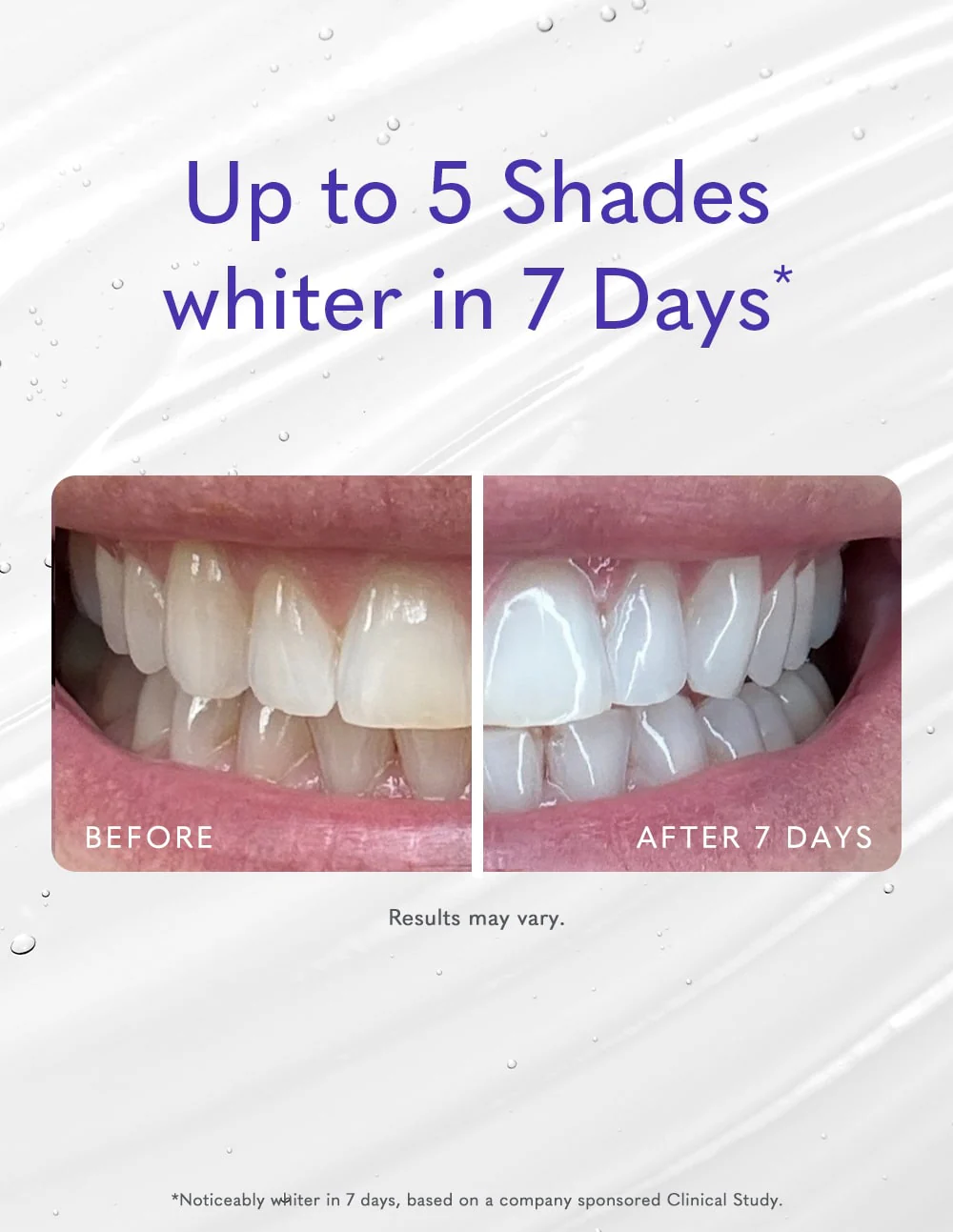 Pro Whitening Gel (Small) - Image 7